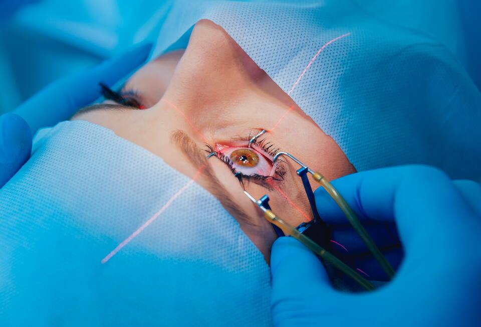 Chirurgie oculaire