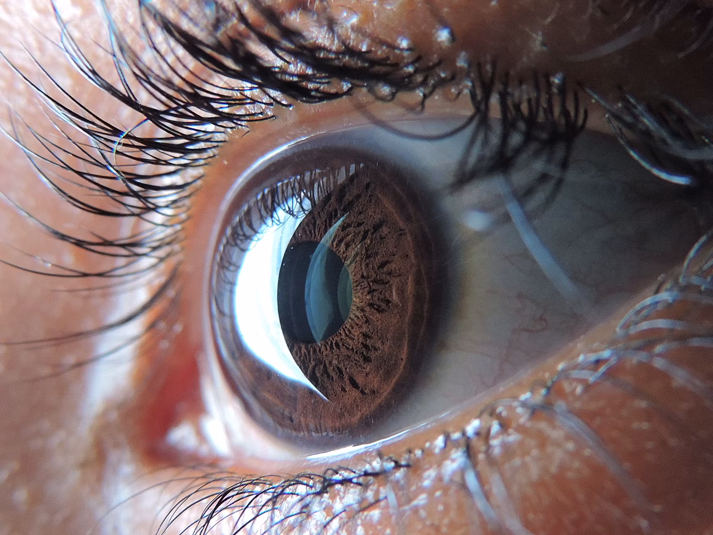 Gros plan sur un œil - Vision latérale