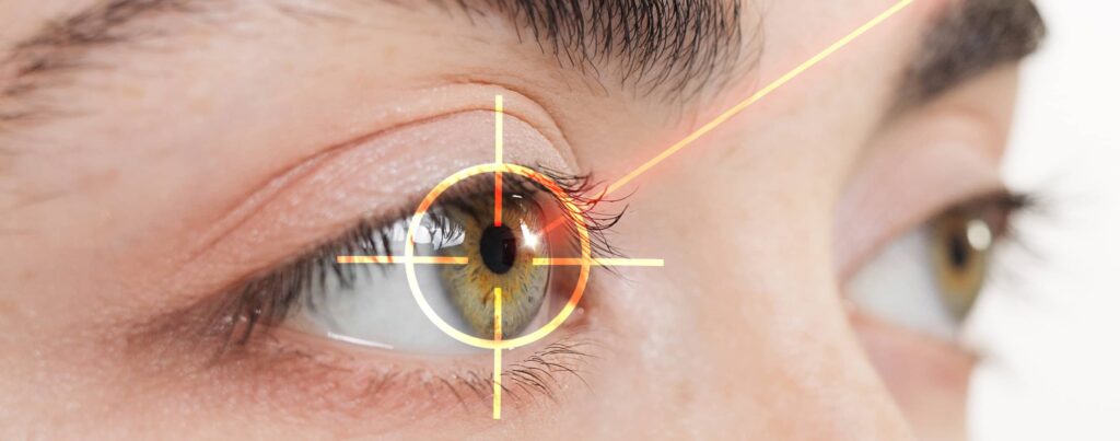 Œil avec cible laser - Correction de la vue